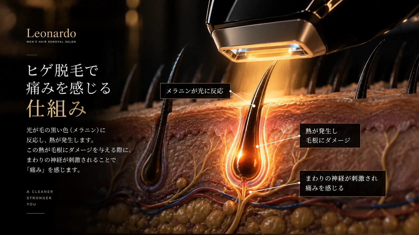 ヒゲ脱毛で痛みを感じる仕組み