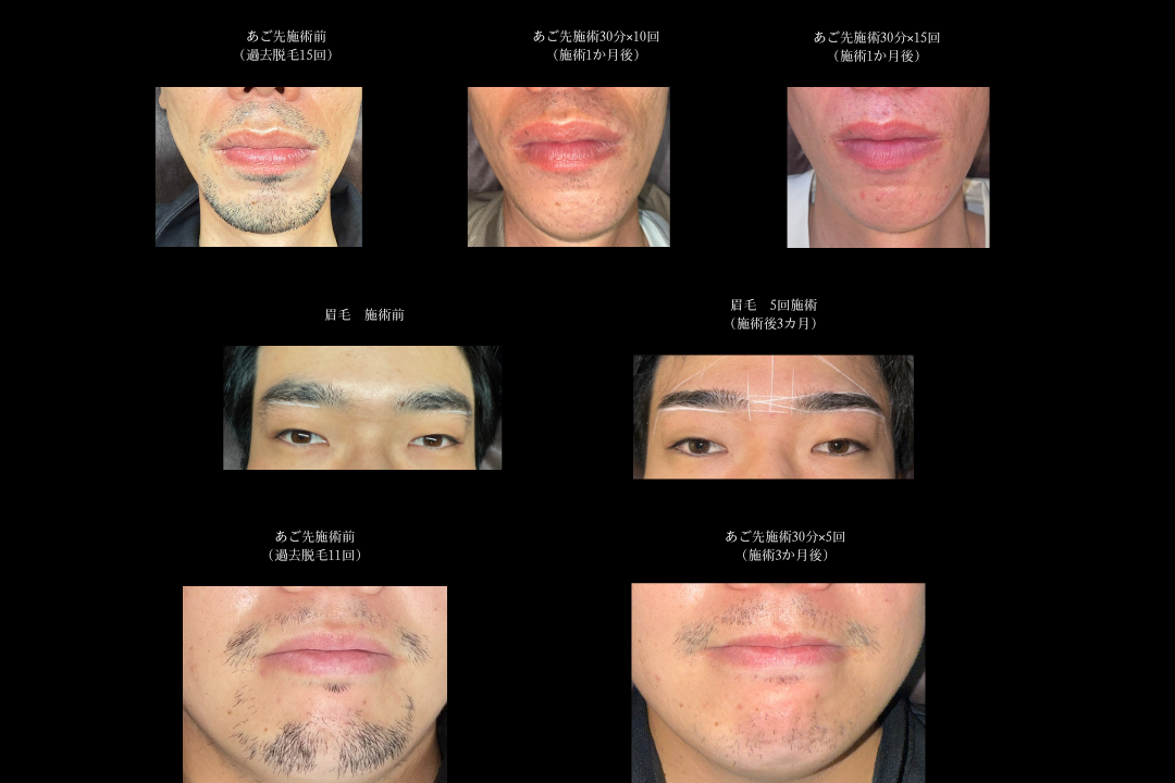 35歳以下の男性を応援!